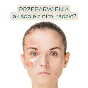 Read more about the article „Nowy” sposób na przebarwienia skóry?